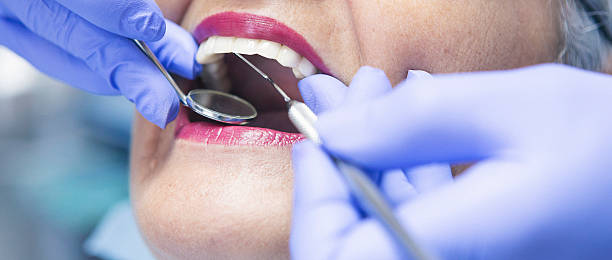 Best Emergency Tooth Extraction in Eddyville, KY