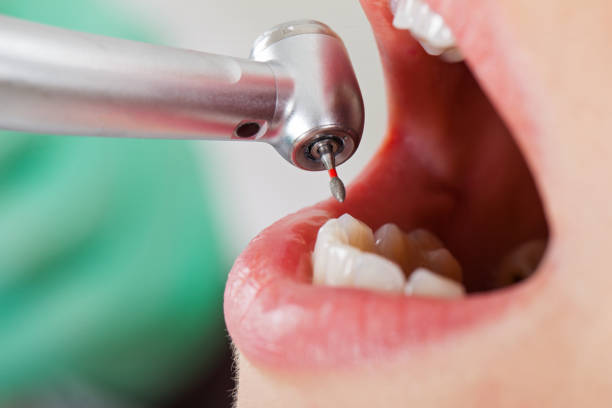Best Emergency Dental Surgery in Eddyville, KY